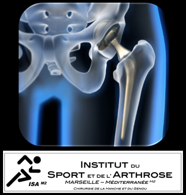 Prothèse de Hanche par Voie Antérieure Mini-Invasive : Livret d'information-patient